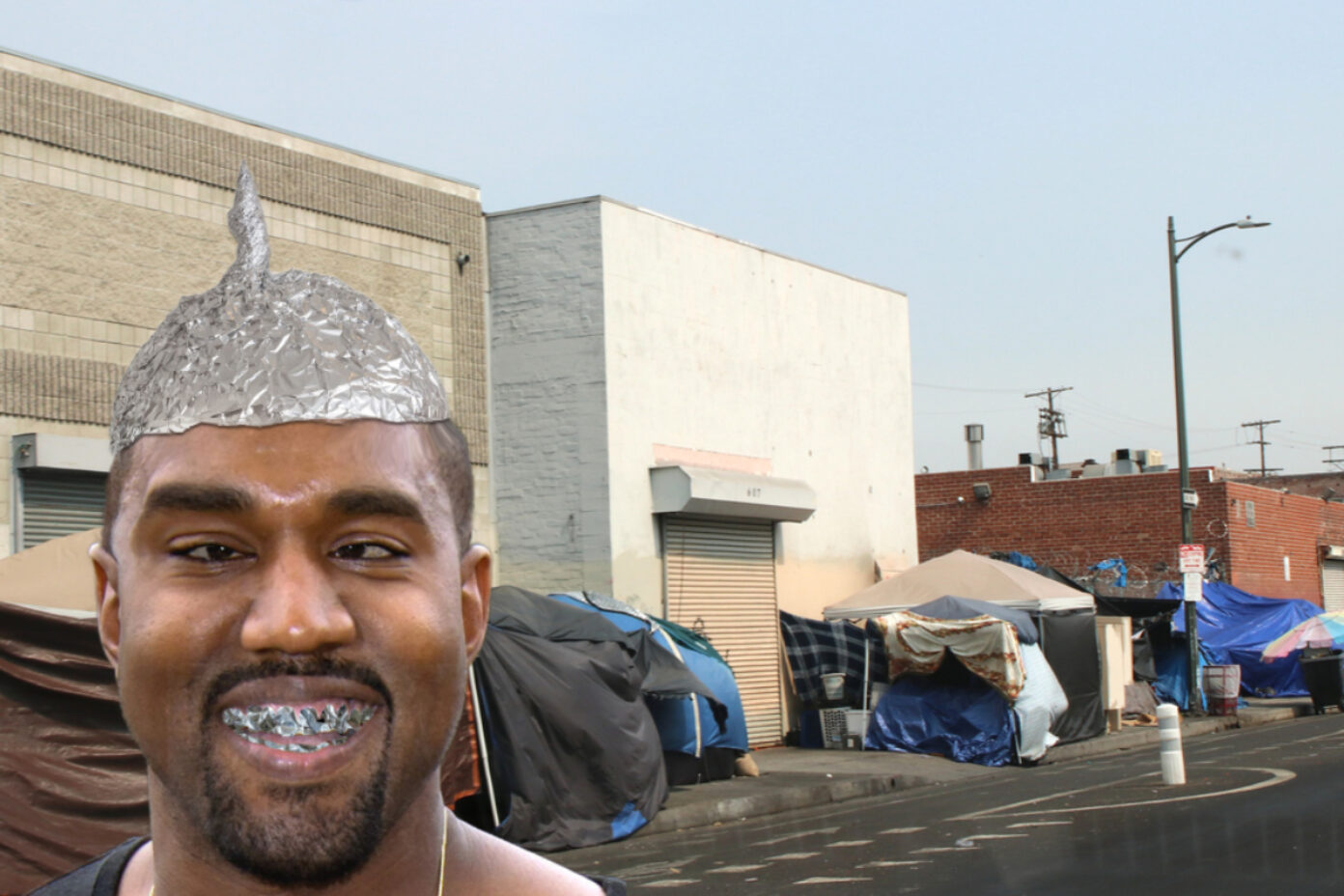 Kanye West Has Teeth REMOVED and Replaced With 2.95 TIN FOIL Dentures