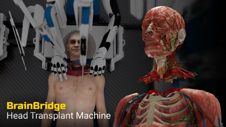 Brainbridge – “Anyone for a head transplant?” WATCH VIDEO